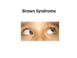 Brown Syndrome