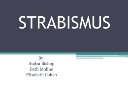 STRABISMUS