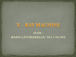 X – RAY MACHINE prezz