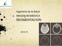 TemaIMB_Segmentacion - ImageN-A image-a