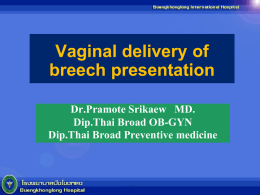 Vaginal delivery of breech presentation