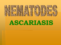 Ascariasis.