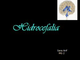 Hidrocefalia - WordPress.com