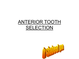 ANTERIOR TOOTH SELECTION