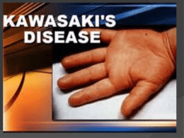 15. Kawasaki Disease - Akademik Ciamik 2010