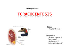 toracocentesis
