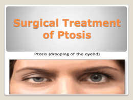 Surgical Treatment of Ptosis