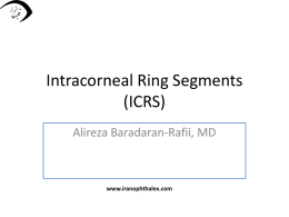 Intracorneal Ring Segments (ICRS)