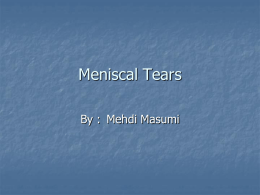 Meniscal Tears