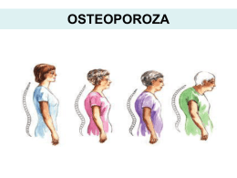 Osteoporoza - Hranom do zdravlja