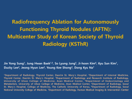 RFA for AFTN(Autonomously Functioning Thyroid Nodule)