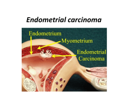 Endometrial carcinoma - Department of Obstetrics and