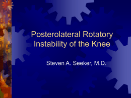 Posterolateral Rotatory Instability of the Knee