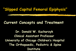 Slipped Capital Femoral Epiphysis”