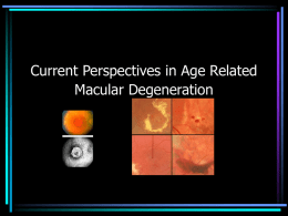 Age related macular degeneration (AMD