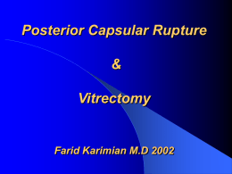 Posterior Capsular Rupture & Vitrectomy