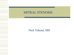 MITRAL STENOSIS - NT Cardiovascular