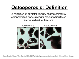 Osteoporosis - Drexel University College of Medicine