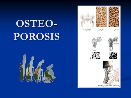 OSTEOPOROSIS, OSTEOMALACIA,RICKETS