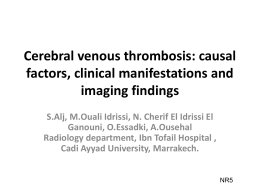 Cerebral venous thrombosis: causal factors, clinical