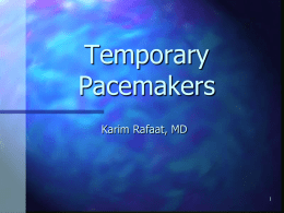 Temporary Pacemakers - University of California, San Diego