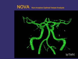 Computer Modeling and Simulation for Neuro Vascular