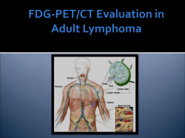 PET-CT Evaluation of Lymphoma
