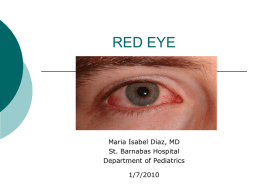 RED EYE - SBH Peds Res
