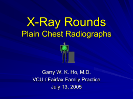 Chest X-Rays - Physioblasts.Org