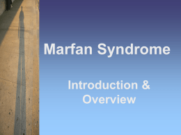 MarFan Overview - Marfan Support and Information