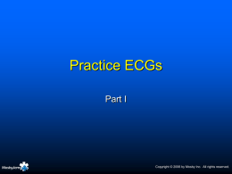 Practice ECGs - Texas Tech University