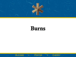 [] Objective 60, Burns