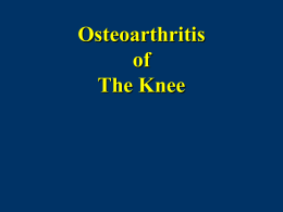 Osteoarthritis of The Knee - AAOS Personal Physician and