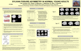 SYLVIAN FISSURE ASYMMETRY IN NORMAL YOUNG ADULTS …