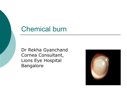 Chemical burn - M M Joshi Eye Institute