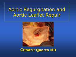 Aortic Regurgitation and Aoortic Valve Repair - Area
