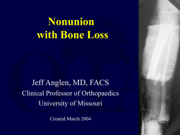 Nonunion with bone loss