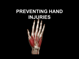 HAND SAFETY - Wellness Proposals