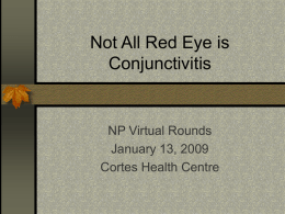 Not All Red Eye is Conjunctivitis