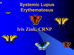 Systemic Lupus Erythematous