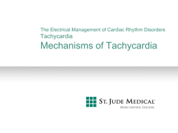Mechanisms of Tachycardia