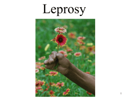 Leprosy - Biol 448B: Fundamentals of Tropical Disease