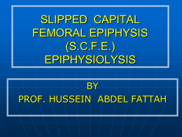 SLIPPED CAPITAL FEMORAL EPIPHYSIS