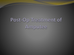 Post-Op Treatment of Amputee