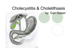 Cholecystitis & Cholelithiasis