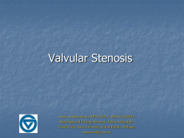 Valvular Stenosis - Grand Valley State University