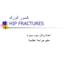 كسور الورك HIP FRACTURES - Muayad Kadhim's WebSite