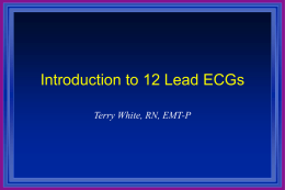 12 Lead ECGs Introduction