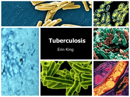 Tuberculosis - Virginia State University