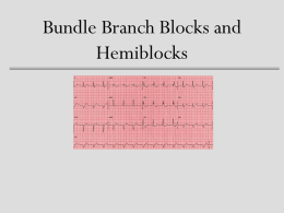 Bundle Branch Blocks and Hemiblocks